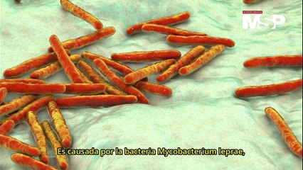 ¿Qué es la lepra y cómo se transmite? Descubre su funcionamiento y prevención 🩺