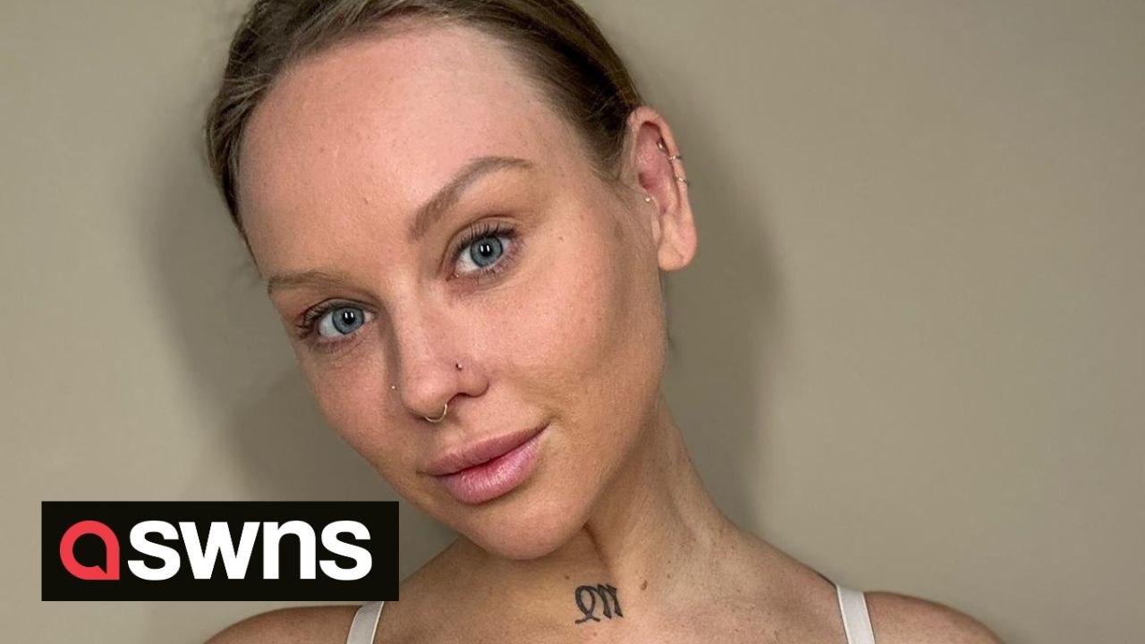 "My breast implants made me go temporarily blind - I had them removed and feel much better"