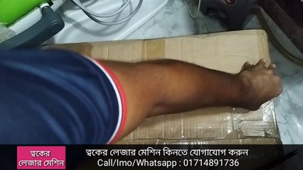 ত্বকের জন্য অত্যাধুনিক উন্নত লেজার মেশিন কিনুন | Skin Laser Macine BD