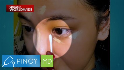 Pagtatanggal ng tear film sa mata, ligtas nga ba? | Pinoy MD
