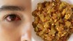 आई फ्लू होने पर क्या खाएं | Eye Flu Hone Par Khaye | Eye Flu Diet in Hindi | Boldsky