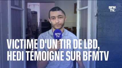 Défiguré par un tir de LBD, Hedi témoigne sur BFMTV