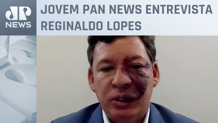 “Política monetária do país prejudica a política fiscal”, diz líder do PT na Câmara