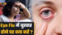 आई फ्लू में बुखार होने पर क्या करें | Eye Flu Mein Fever Hone Par Kya  Kare |Boldsky
