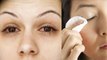 आई फ्लू में आंखो को साफ़ कैसे करें | Eye Flu Me Eye Clean Kese Kare | Boldsky