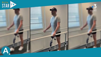 Matthieu Lartot : Après son amputation, il affiche sa prothèse pour la 1ère fois... "Bionic Mat" fai