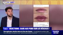 Injections pour des lèvres pulpeuses: comment TikTok diffuse des publicités en toute illégalité