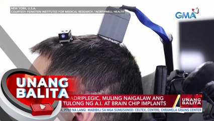 Lalaking quadriplegic, muling naigalaw ang kamay sa tulong ng A.I. at brain chip implants