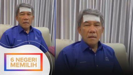 Tok Mat dijangkiti influenza, rehat tiga hari daripada berkempen