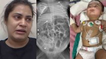 Kritika Malik Son Zaid का Intestine Operation Successful, Hospital Reels पर Family Troll | Boldsky