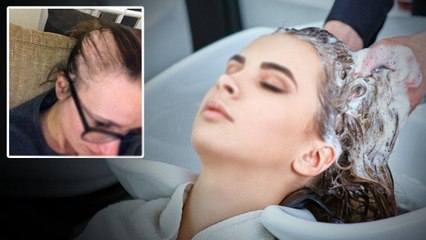Beauty కోసం Beauty Parlour వెళ్తే ఉన్న జుట్టు పోయి బట్టతల... Hyderabad లో సంఘటన.. | Telugu OneIndia