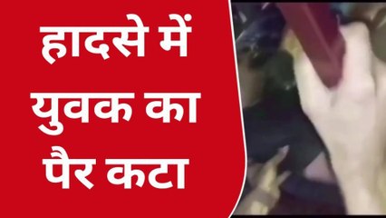 लखनऊ: तेज रफ्तार का दिखा कहर,बस का पहिया चढ़ने से युवक का पैर कटा