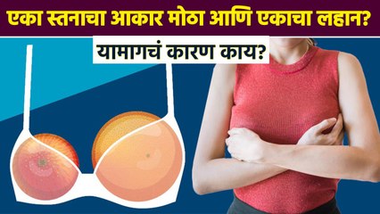 एक स्तन लहान आणि एक मोठं म्हणजे कोणता आजार ? | Asymmetric Breast | Types Of Breast | RI3