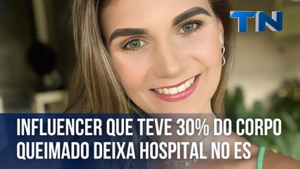 Influencer que teve 30% do corpo queimado em churrasco deixa hospital