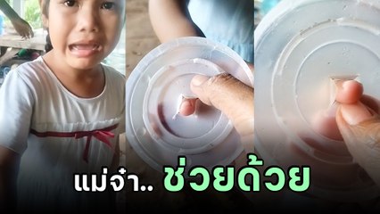 จุดจบเด็กดื้อ เล่นซนจนนิ้วติดออกไม่ได้ แต่เดี๋ยวนะ.. ต้องขำ หรือสงสารดี !?