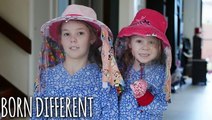 The Sisters Who Can't Go Out In Sunlight | BORN DIFFERENT