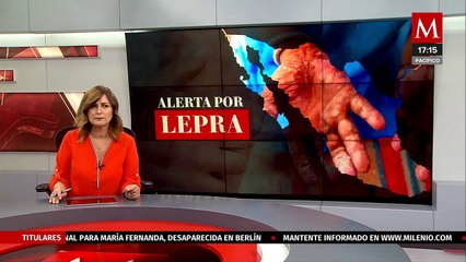 No hay que alarmarse, la lepra no se transmite con facilidad: Alejandro Macías, infectólogo