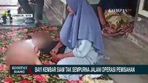 16 Dokter Spesialis Terlibat dalam Operasi Pemisahan Bayi Kembar Siam di Lombok