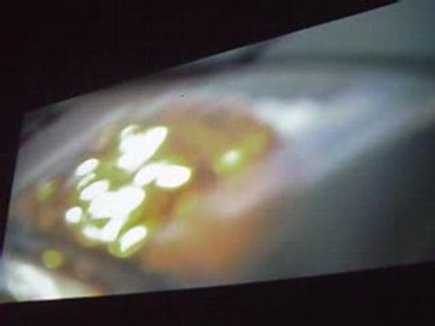 ZEMOS98 10a Pantallas paralelas miercoles