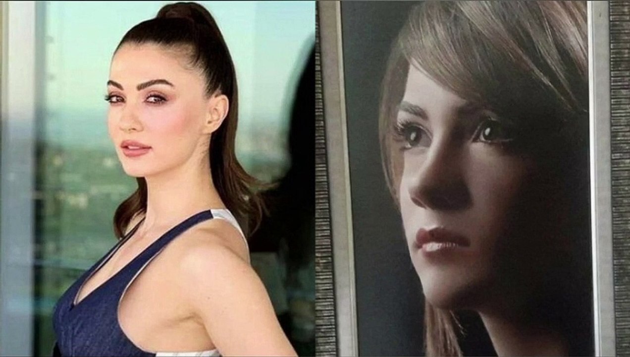 Tout le monde pensait que c'était une beauté naturelle ! Ceux qui ont vu Burcu Özberk sans esthétique ont été détruits
