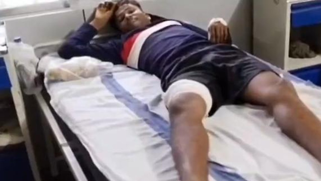 बालाघाट: एयरगन से घायल हुआ युवक, डॉक्टरों ने ऐसे बचाई जान