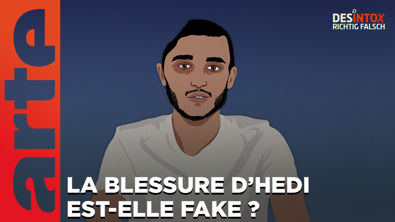 La blessure d'Hedi est-elle fake ?