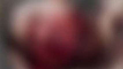 అల్లూరి జిల్లా: "ఆందోళన వద్దు.. ప్రాణాపాయం లేదు"