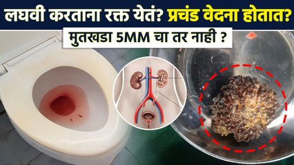 मुतखड्याकडे किती दिवस करणार दुर्लक्ष ? | Kidney Stone | Blood Through Urine | Lokmat Sakhi | RI3