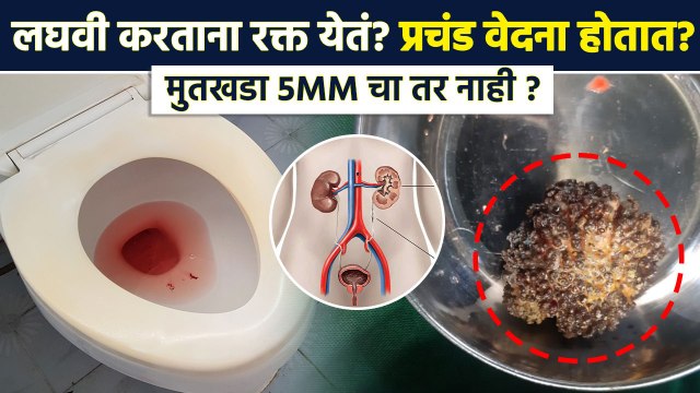 मुतखड्याकडे किती दिवस करणार दुर्लक्ष ? | Kidney Stone | Blood Through Urine | Lokmat Sakhi | RI3