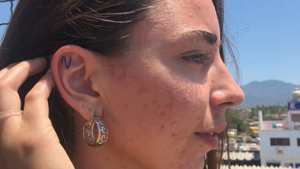 Vegan Quits Diet After Almost Dying