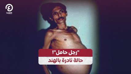 "رجل حامل"!.. حالة نادرة بالهند