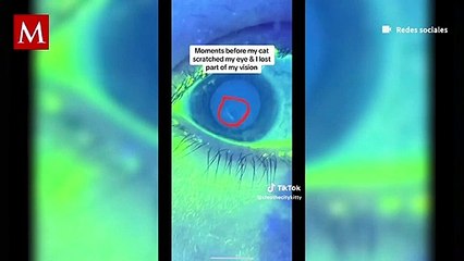 Gato deja ciega a su dueña mientras jugaban; así fue como ocurrió el accidente