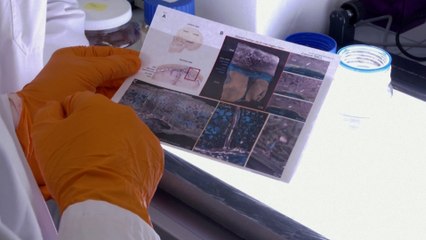 ابتكار جديد.. تقنية تشخيص قد تساعد في تشخيص وعلاج أمراض الدماغ