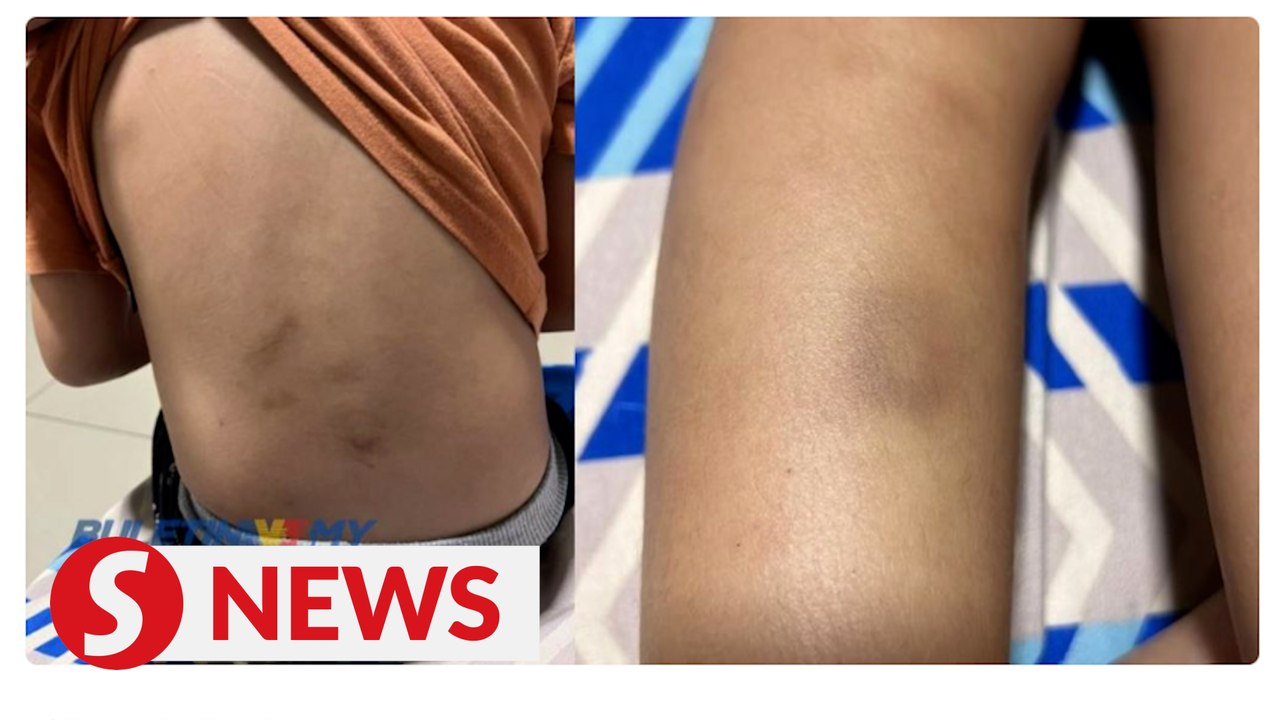 KK childcare centre worker under investigation for child abuse