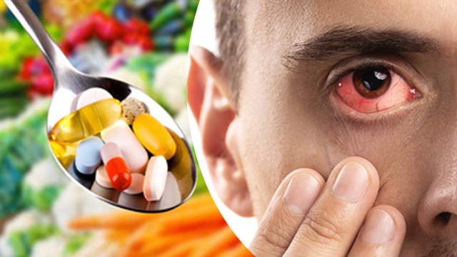 इस विटामिन की कमी से आई फ्लू कैसे होता है | Is Vitamin Ki Kami Se Eye Flu Kaise Hota Hai |