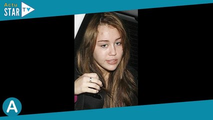 Acné  Une étrange et dangereuse technique fait fureur sur TikTok, convulsions, coma