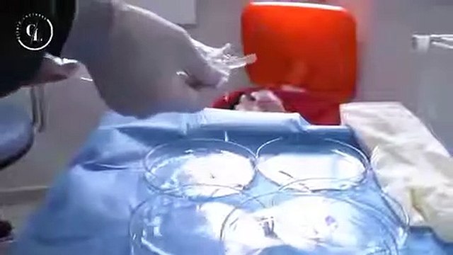 Safir Fue Saç Ekimi Ücretsiz Muayene - Kardelen Tıp Merkezi