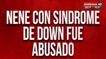 Tremendo: nene con síndrome de edad fue abusado sexualmente