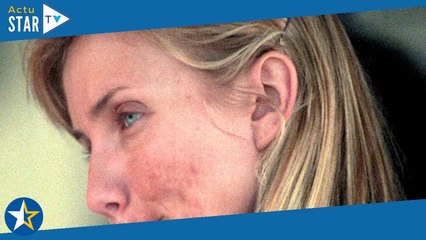 Un ingrédient qu'on a tous dans nos cuisines peut vous offrir une peau parfaite