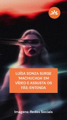LUÍSA SONZA SURGE 'MACHUCADA' EM VÍDEO E ASSUSTA OS FÃS; ENTENDA