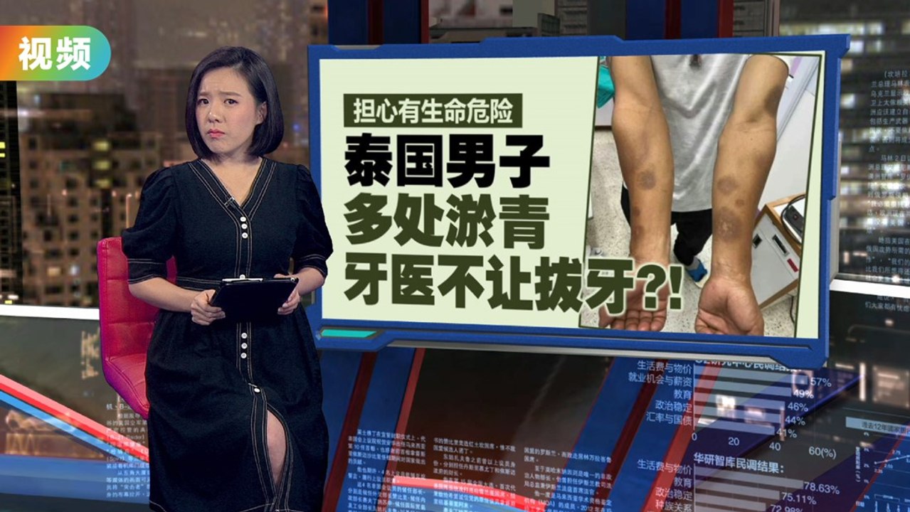 “血小板低下症”多处淤青   牙医不让拔牙恐致命