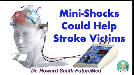 Mini-Shocks Could Help Stroke Victims