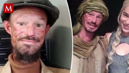 Murió Darren Kent, actor de Game of Thrones; esto sabemos sobre su fallecimiento