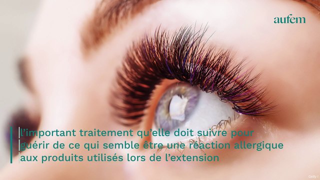 Réfléchissez à deux fois avant de faire des extensions de cils , une cliente partage sa terrible expérience