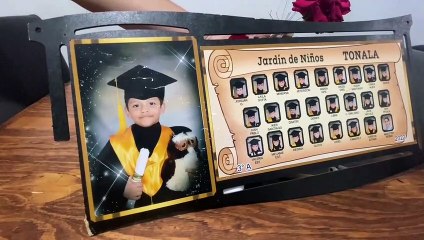 El pequeño Dimitri necesita con urgencia una operación en su ojo, de no realizarla podría perderlo. El costo de la cirugía asciende a 38 mil pesos, su familia no cuenta con las posibilidades económicas en este momento, por lo que solicitan apoyo a la comu