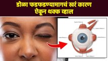 डोळा फडफडण्यामागचं खरं कारण कधीच ऐकलं नसेल | Eye Twitching | Eye Infection | Lokmat  Sakhi | RI3