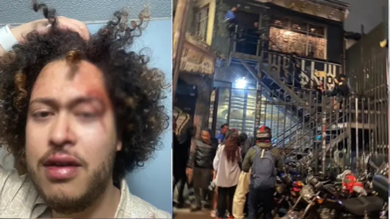 Me tiran por las escaleras y allí me cogen a patadas y a puños: Joven presuntamente agredido en bar de Bogotá
