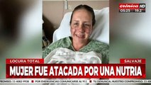 Fue atacada por una nutria y sobrevivió de milagro