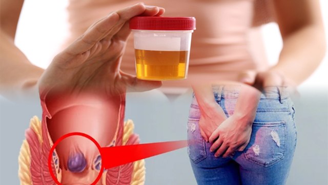 Peshab Se Bawaseer Ka Ilaj Hota Hai Kya | पेशाब से बवासीर का इलाज होता है क्या | Boldsky