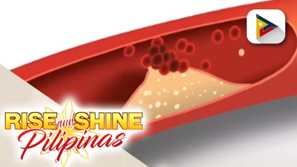 SAY ni DOK | Imbalance ng cholesterol sa katawan